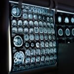 x-ray, mri, ct scan, computed tomography, magnetic resonance imaging, medicine, neurology, healthcare, x-ray, mri, mri, mri, mri, mri, ct scan, medicine, neurology, neurology, healthcare, healthcare